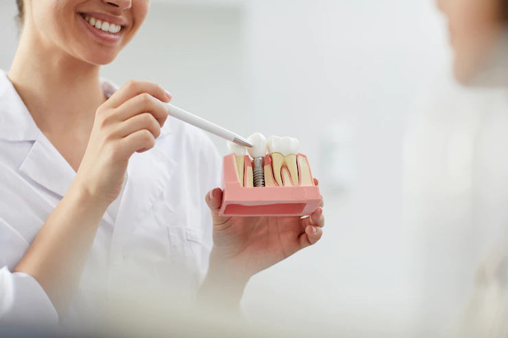 Como o implante dentário pode ajudar pessoas que sofrem com a falta de dentes